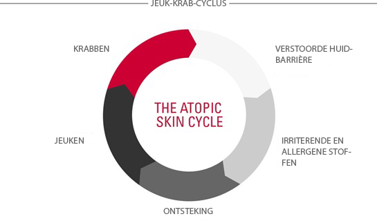 Atopische huid