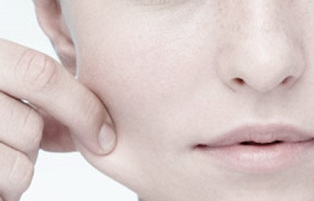 minder veerkrachtige huid