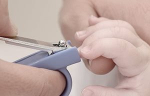 Atopische dermatitis